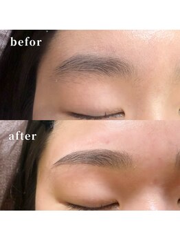 プロケア リッシュ(Procare Riche)/