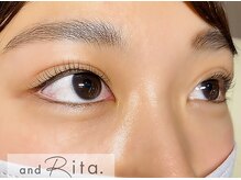 アンドリタ/超ダメージレスマツパ