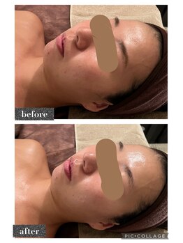 マンダ 田町(Manda)/冬場の乾燥、肌荒れも改善します