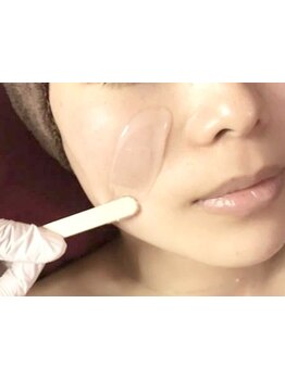 顔脱毛がしたい