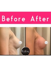 エルフラージュ 銀座店/トップｃｍ↑↑UP