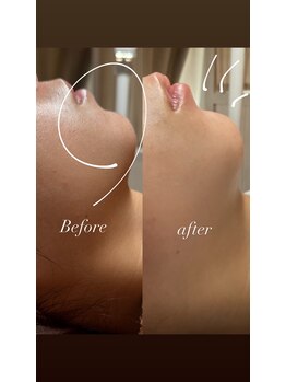 ステライチマルサン(stella.103)/フェイシャルワックス