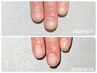 【すぐ折れる・薄い爪】爪質改善×縦長美爪ジェル育成コース体験☆オイル付