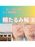 【たるみケア/ほうれい線/小顔】リフトアップ！ヒト幹細胞上清液フェイシャル