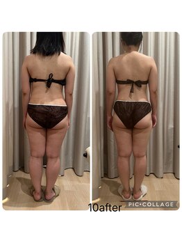 ラナン(ranan)/筋膜リリースセルケア