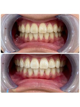 コナホワイトニング 神保町/セルフホワイトニング神保町