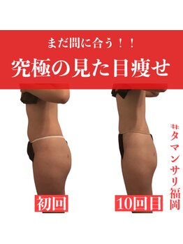 タマンサリ(Taman Sari)/30代からの徹底痩身