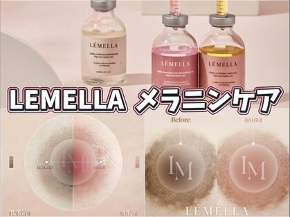 ジュエリーボディー(Jewelry body)の写真