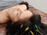 【2回目以降もお得】抜け毛・不眠に◇頭皮鍼(電気付き) ¥7700→¥6980