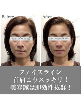 ハリサロンドオフ 心斎橋店(hari salon de off)/首の長さ・フェイスラインに注目