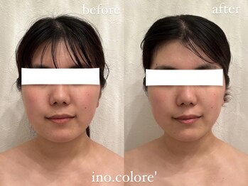 リノコロレ(ino.colore')/【ブライダルコルギ】×1回