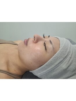 シミしわ改善！予防ケア