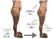 サロン ド リシャス(Salon de Licious)の雰囲気（ラジオ派＋強力吸引マシン全身ほぐし｜スタイルアップ↑）