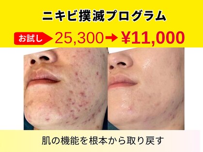 フロート(float)の写真