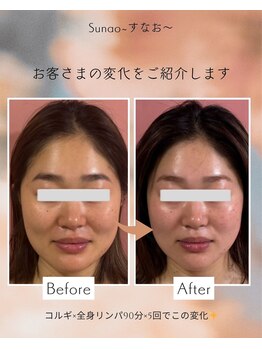 すなお 溝の口(Sunao)/【小顔コルギ】20代お客様