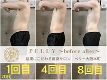 ペリー(PELLY)/男性20代　before after