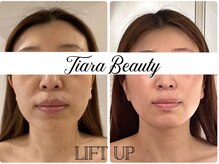 ティアラビューティの雰囲気（開業以来の鉄板人気【小顔コルギ・リフティング】ここぞの時に！）