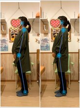 すぎうら整体院 浜松院/姿勢の変化