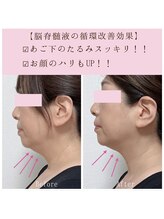 ビーホリック(Bholic)/顎下のたるみ