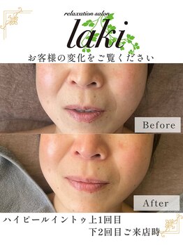 リラクゼーションサロン ラキ(laki)/ハイピールイントゥ
