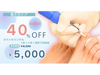 小田急相模原巻き爪センター 南口院の写真/今が巻き爪ケアのチャンス！どんな巻き爪でも対応。巻き爪の状態に合わせて丁寧に施術いたします♪