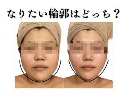 トータルビューティーサロン レビュー(REVIEW)の写真
