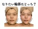 トータルビューティーサロン レビュー(REVIEW)の写真
