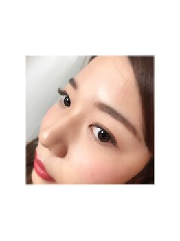 チャーミング(Charm Wink)/