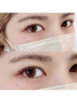 オルト(ORT)/ラッシュリフト