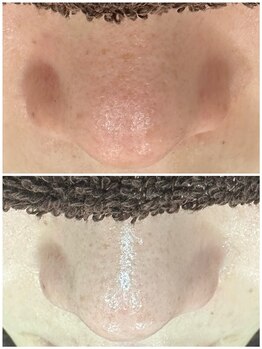 エクラ バイ シャンリィ(eclat by shanLy)/トーンアップ効果もあり！