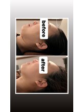 みずわき治療院/フェイスライン変わります♪