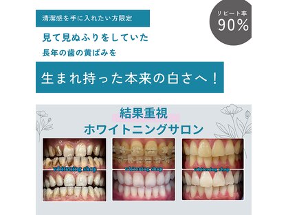 ホワイトニングショップ 天王寺店の写真