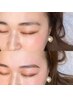 【全員】美眉＋美肌フルフェイスWAX【セット】ハイドロジェリー全顔付！