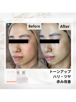 ルアナ(Luana)/ララピールの効果★