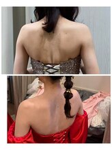 サンテボーテ(Sante Beaute)/ブライダルエステ