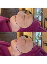 小顔フェイスラボ 鈴鹿店(小顔FaceLabo.)/◆目元の小じわ改善◆