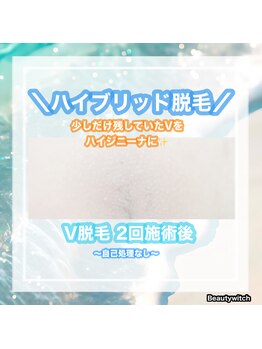 ビューティ ウィッチ(Beauty Witch)/