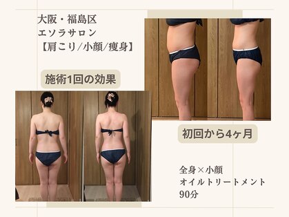 エソラサロンの写真