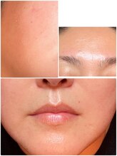 アストリア(ASTORIA)/50代ノーメイク加工なし