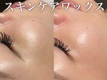 トゥウィーサロン 梅田(Tweesalon)/ツヤ肌フェイシャルワックス