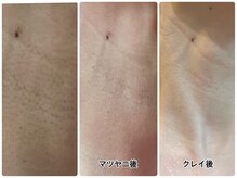 ヒーリングヘッドストーリー(healing head story)/お首のケア