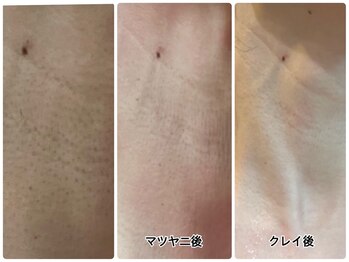 ヒーリングヘッドストーリー(healing head story)/お首のケア