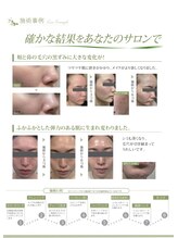 ルーチェット(luceat)/