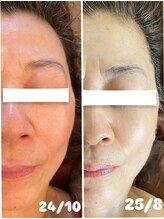 ナオフクオカ ヒーリングフォースエヌ(NaoFukuoka/healingforceN)/ヒト幹細胞でスペシャルケアを。