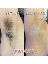 ステイゴールド 新百合ヶ丘(STAY GOLD)/初回は大変だけど、、、