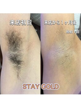 ステイゴールド 新百合ヶ丘(STAY GOLD)/初回は大変だけど、、、