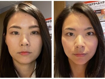 キワミ(KIWAMI)/＃首専門＃恵比寿整体＃整体