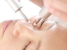 アイジー(iG)/繊細で高い技術になっとく