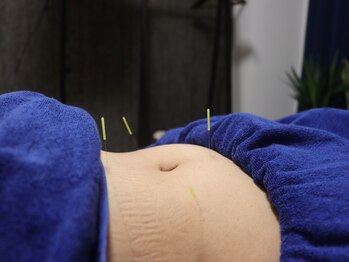 鍼灸整体院アレンジ/身体の内側から状態を整える♪