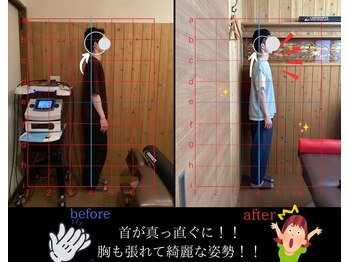 栄光治院 岡崎本院/たったの【10分】でいい姿勢に!